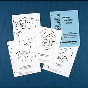 Human Chromosomes, Trisomy 21 Down Syndrome, Biophoto(r) Sheets, Pad 