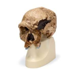 Anthropological skull   Steinheim  Industrial & Scientific