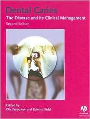 Dental Caries The Disease and Its Clinical Management, (1405138890 
