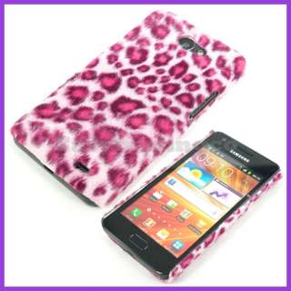 Pink Furry Leopard Back Cover Case Samsung i9103 Galaxy R  